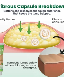 Cvreoz® Knot-X Lipoma Dissolve Cream