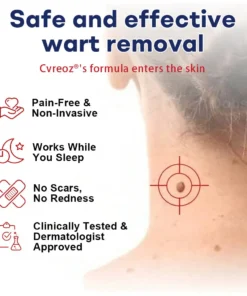 Cvreoz® Mole and Wart Removal Cream