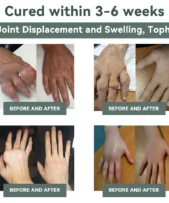 Cvreoz® Nerve Repair &Pain Relief Magnesium Cream