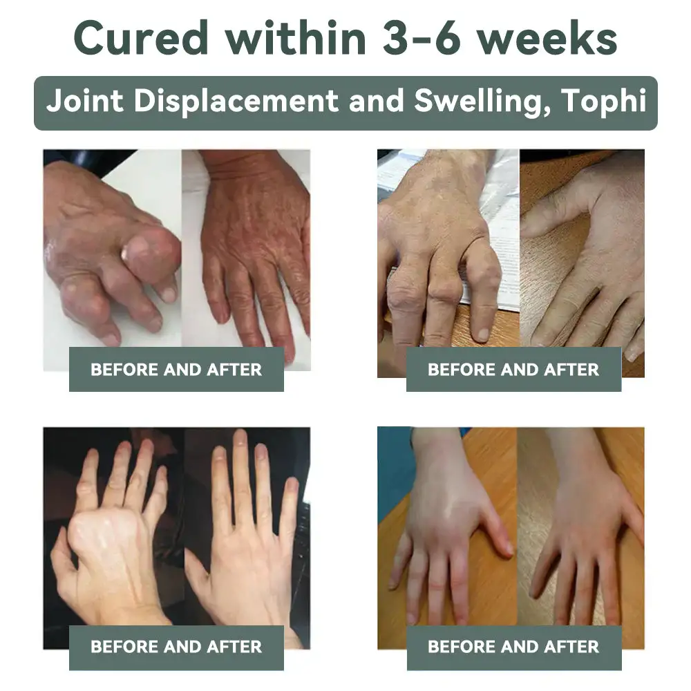 Cvreoz® Nerve Repair &Pain Relief Magnesium Cream