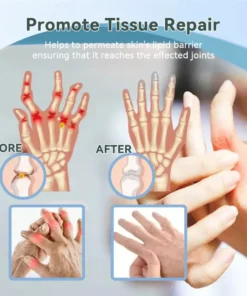 Cvreoz® Nerve Repair &Pain Relief Magnesium Cream