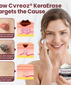 Cvreoz® OryzaClear Black Rice Botanical Keratin-Softening Cream