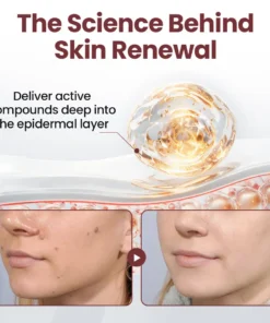 Cvreoz® OryzaClear Black Rice Botanical Keratin-Softening Cream