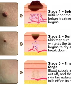 Cvreoz® Pro-Repair Black Rice Concentrate Cream