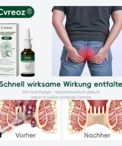 Cvreoz® SCHNELLWIRKSAMES HÄMORRHOIDEN-PRO SPRAY