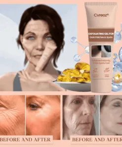 Cvreoz® Purifying Exfoliating Gel for Acanthosis Nigricans, Exfoliation, Dark Spots, Skin Tags, and Eczema