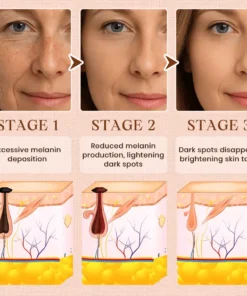 Cvreoz® Purifying Exfoliating Gel for Acanthosis Nigricans, Exfoliation, Dark Spots, Skin Tags, and Eczema