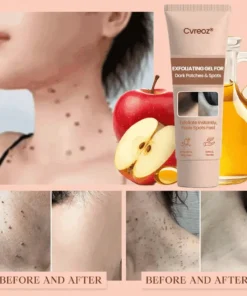 Cvreoz® Purifying Exfoliating Gel for Acanthosis Nigricans, Exfoliation, Dark Spots, Skin Tags, and Eczema