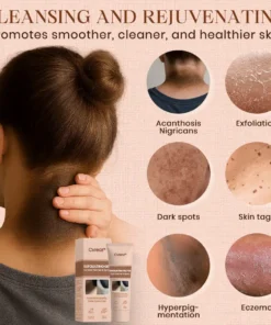 Cvreoz® Purifying Exfoliating Gel for Acanthosis Nigricans, Exfoliation, Dark Spots, Skin Tags, and Eczema
