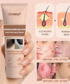 Cvreoz® Purifying Exfoliating Gel for Acanthosis Nigricans, Exfoliation, Dark Spots, Skin Tags, and Eczema