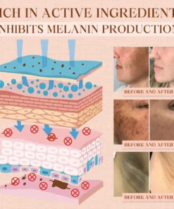 Cvreoz® Purifying Exfoliating Gel for Acanthosis Nigricans, Exfoliation, Dark Spots, Skin Tags, and Eczema